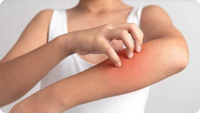 Gut-Skin Connection: How Digestive Resilience Improves Skin