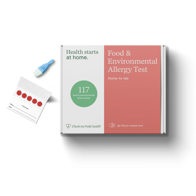 Food & Environmental Allergy Test