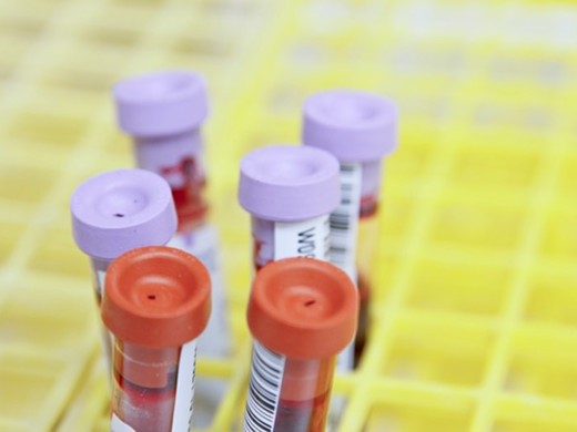 NHS gold-standard IgE testing — brought directly to your home